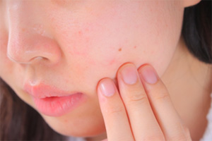 フォトフェイシャルステラM22